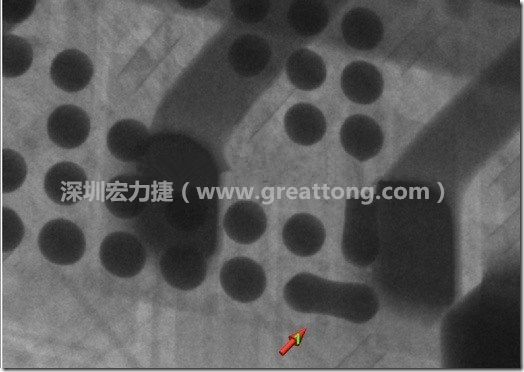 BGA因?yàn)楹笁|變小，造成錫膏過(guò)多而最終形成焊接短路的結(jié)果。
